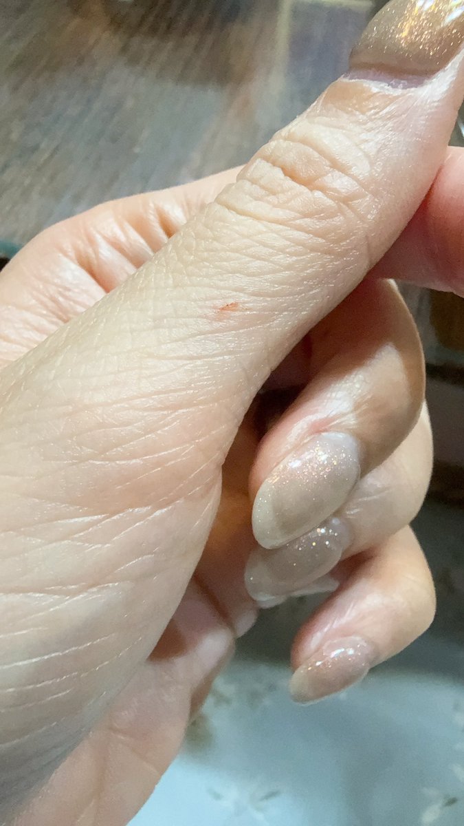 大年初一就見紅😡
真的不能剛睡醒就拿剪刀開東西耶
方向拿反就戳到內傷了，還好沒破皮