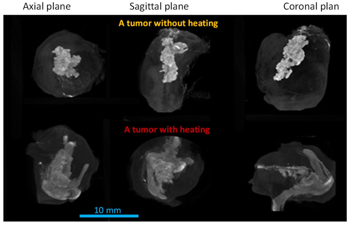 Bioeng_MDPI's tweet image. 💥Highly recommended publication: "Heating Induced Nanoparticle Migration and Enhanced Delivery in Tumor Treatment Using Nanotechnology"
🔗mdpi.com/2306-5354/11/9…
🏫@UMBC
📌#LowBackPain #SpineCare #Bioengineering
