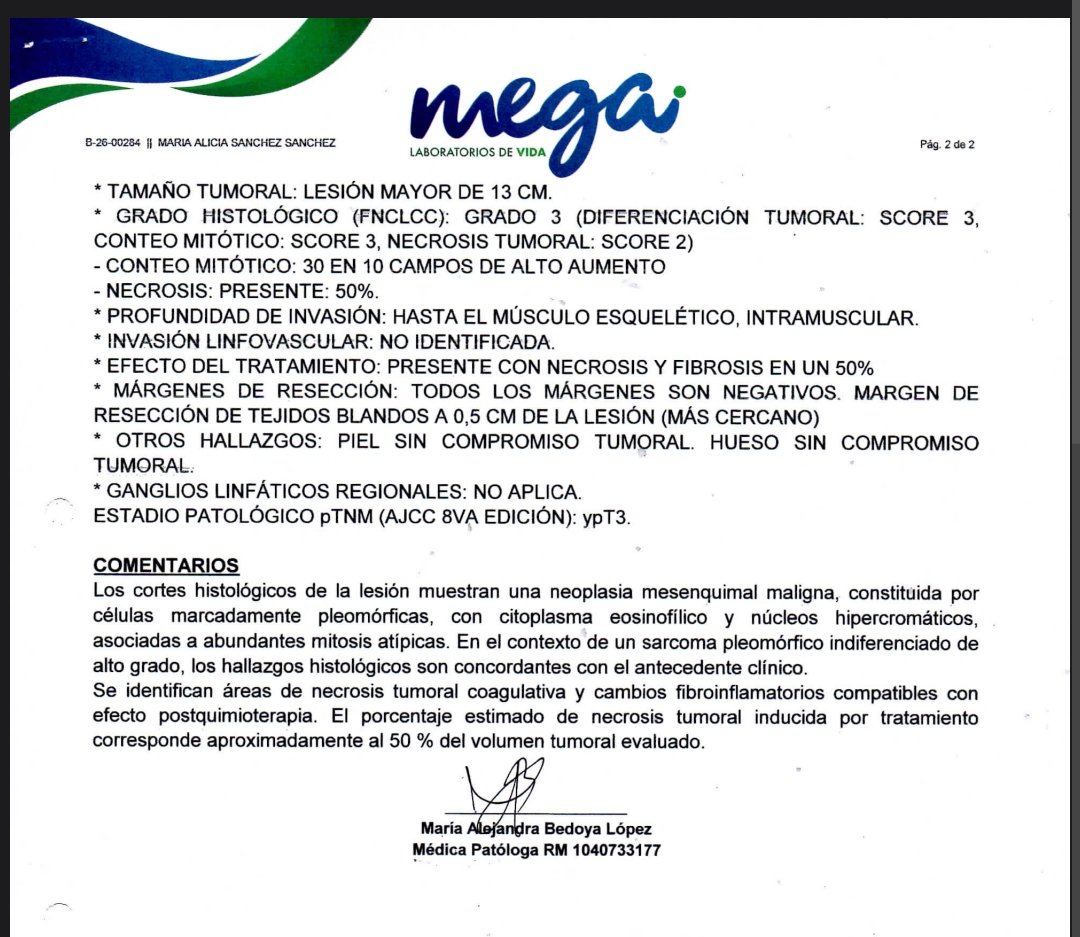 Lamentablemente a mí mamá le hicieron hace 2 semanas una desarticulacion de cadera (la amputación más alta que hay) debido a una recaída de un sarcoma de tejidos blandos en el miembro inferior izquierdo y próximamente debe ser sometida a quimioterapia.

Estoy recaudando fondos