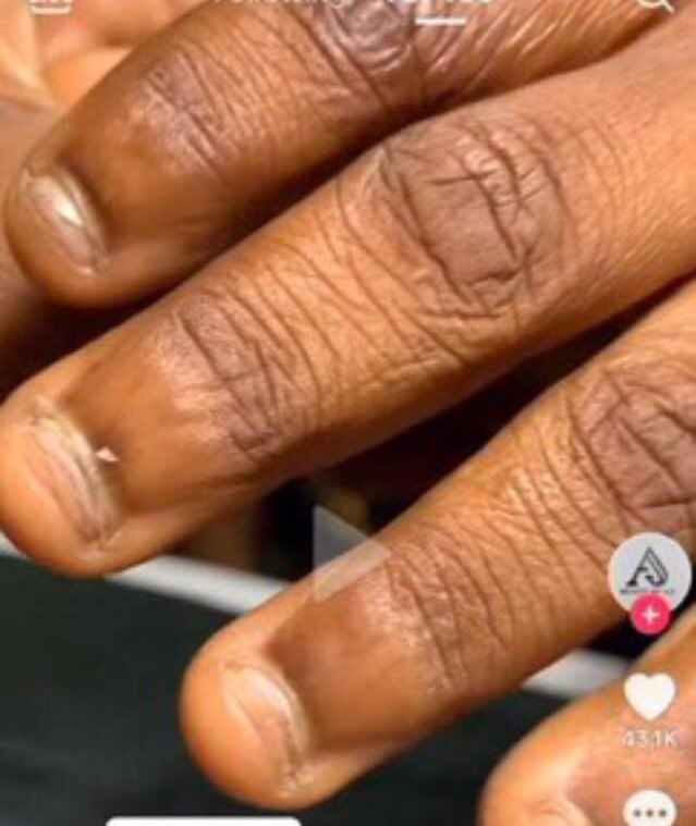 Facts about pple with this type of hand ?