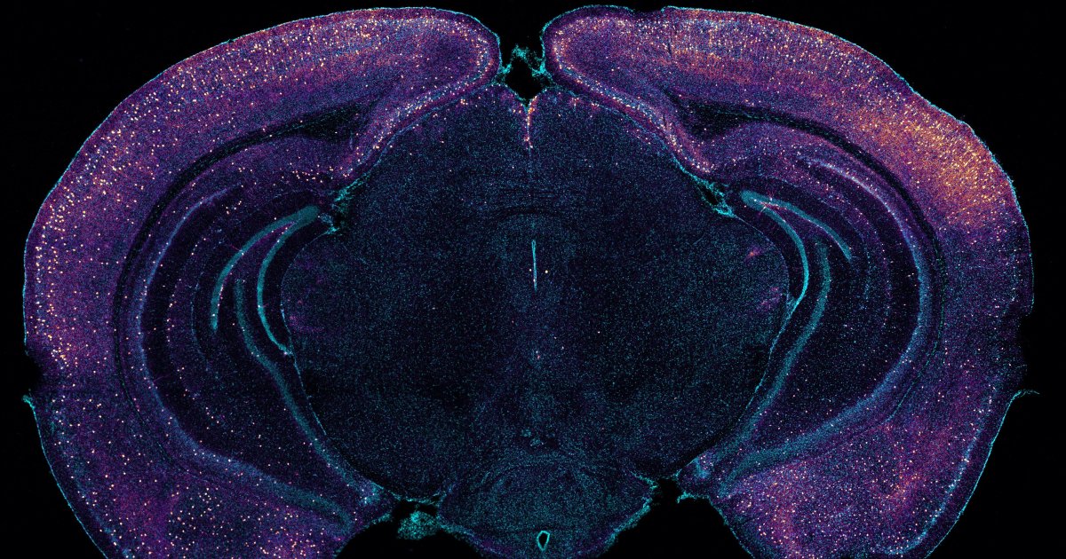 🚨: MIT researchers cleared 50% of Alzheimer’s plaques
using 40 Hz sound waves ─ no drugs─ no surgery. 

Just frequency.