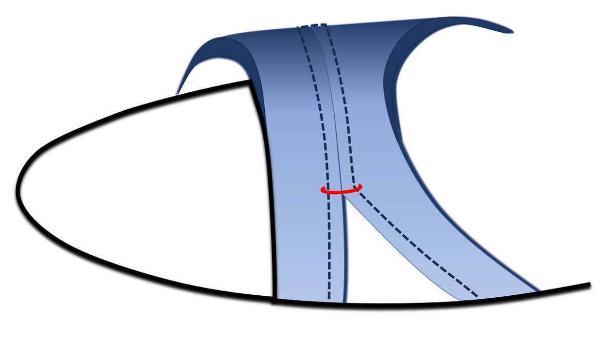 thefootwearedge's tweet image. Footwear Manufacturing Insights: Stitch-In Insoles Design and Bar-Tack Reinforcement for Structural Security

Read More: thefootwearedge.com/footwear-manuf…

#bartacking #footwearmanufacturing #bestpractices #california #stitching  #insoles
