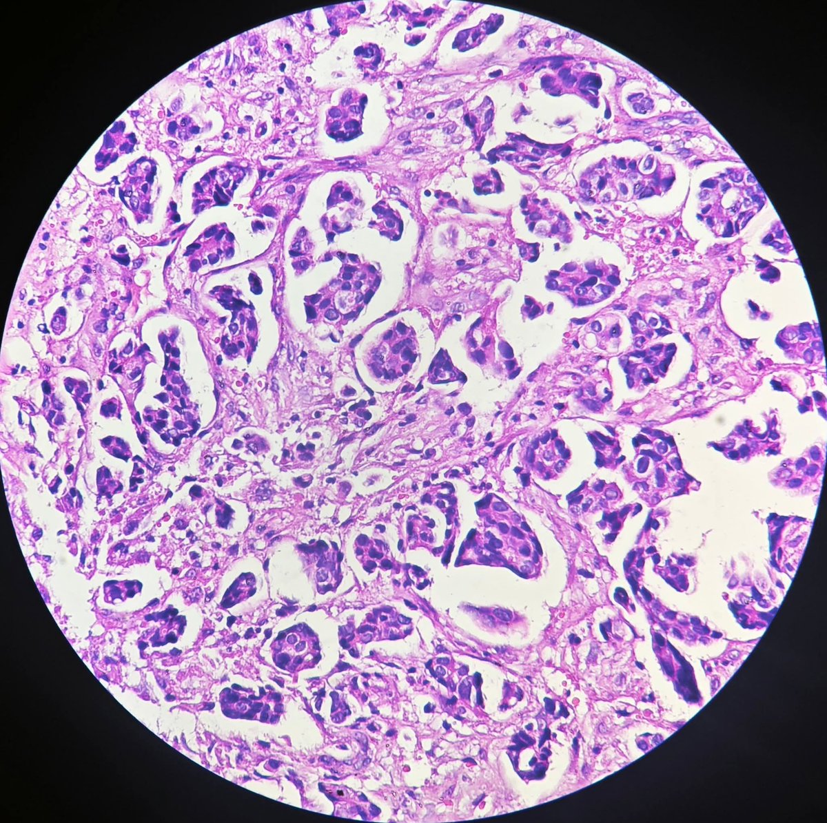 aung phyo tweet media