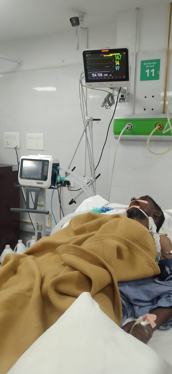 My Dad Underwent emergency debridement surgery. Due to severe infection, 3 toes had to be removed to prevent further spread &amp; save the leg.
He was briefly unstable post-op kept in ICU.
Next will be treating the infection &amp; planning for peripheral angioplasty.
Pray for him 🙏