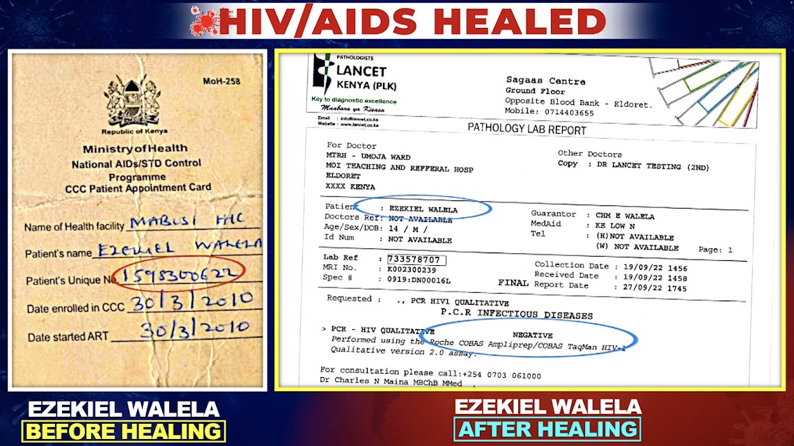 CrossDonee's tweet photo. Meet Ezekiel Walela from Matunda, Kenya with his ARVs . Diagnosed with HIV/AIDS at birth, he was on ARVs for 13 years. 
 
His life changed after encountering Prophet Dr. David Owour at a healing service in Nairobi. The Prophet cursed the HIV virus,  #HIVBowsToChrist https://t.co/Pt80xKbHxN