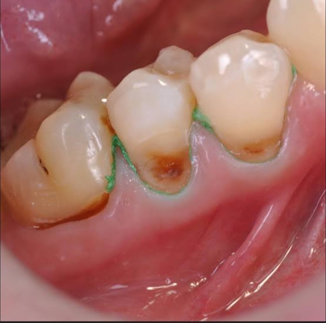 coasslyfe tweet media