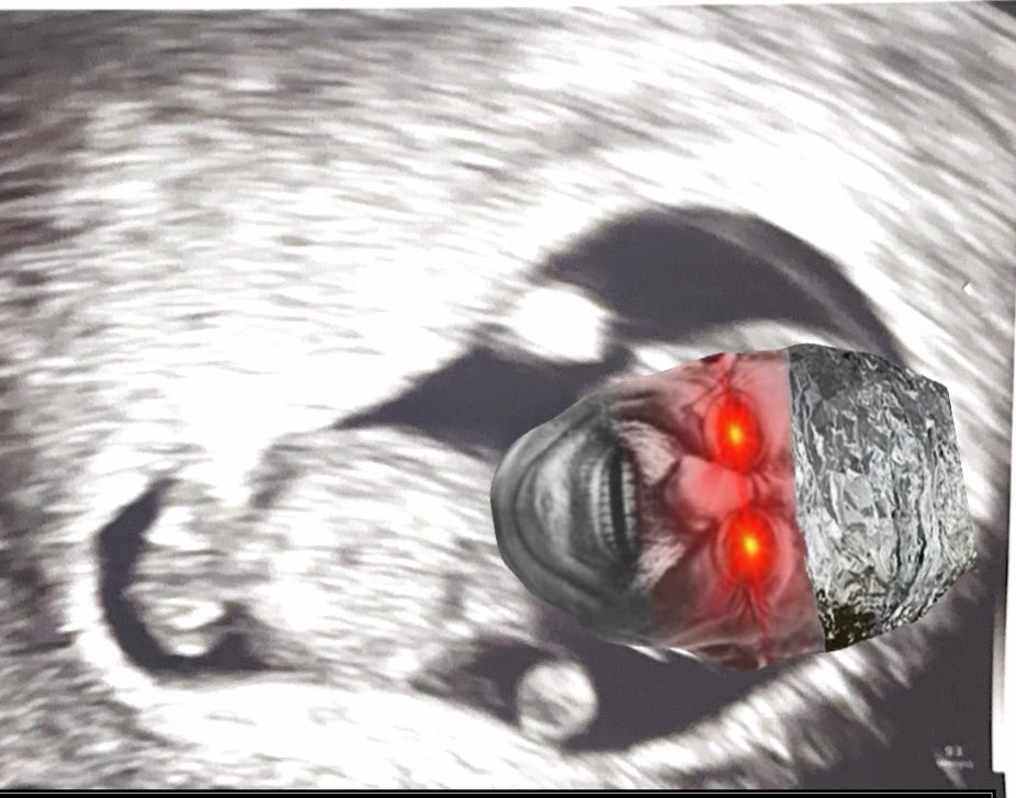 Oilfield Rando tweet media