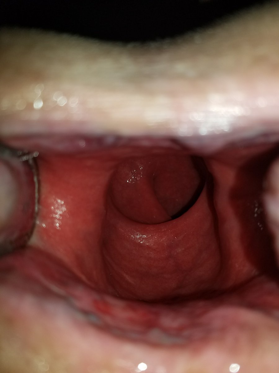 BiColorado tweet media