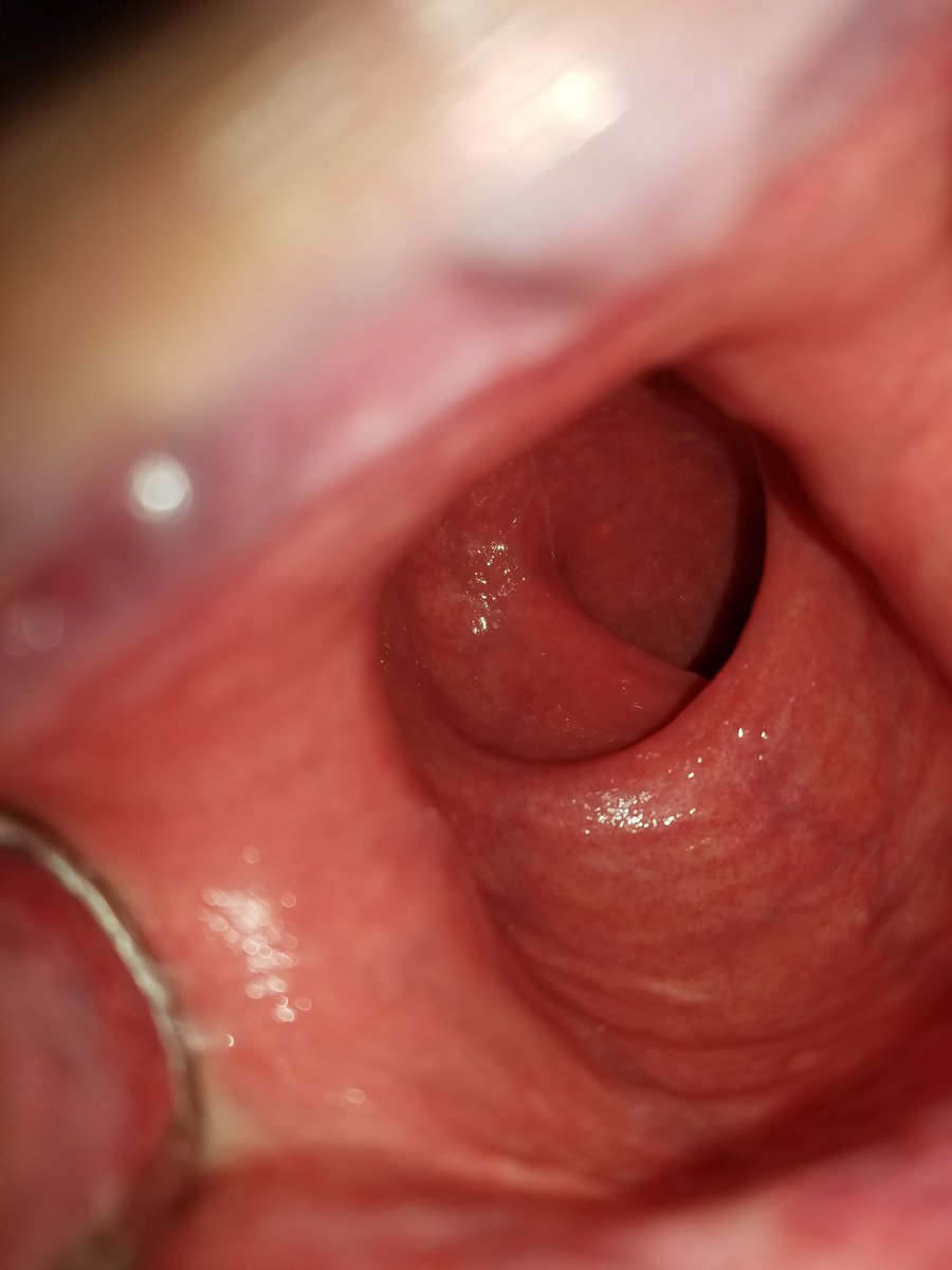 BiColorado tweet media