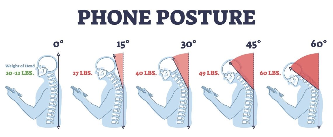 Dealing with chronic brain fog or headaches? It might be a plumbing issue, not a mental one. 
🧠 New case studies reveal "Postural IJV Stenosis"-where forward head posture literally traps blood in the cranium, blocking flow to the heart. Your posture is suffocating your brain. 👇
