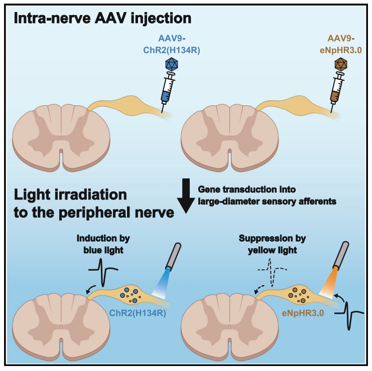 doriclenses's tweet image. 🧩 A recent study by Kosugi et al. (2025) in #iScience used #Doric_Lenses #LISER to control peripheral sensory nerve activity. Using  #LISER blue (for #ChR2) and yellow (for #eNpHR3.0) light stimulation, fibers were activated or inhibited in an intensity-dependent manner.