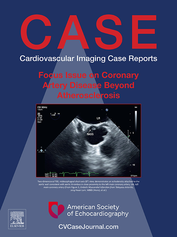 American Society of Echocardiography tweet media