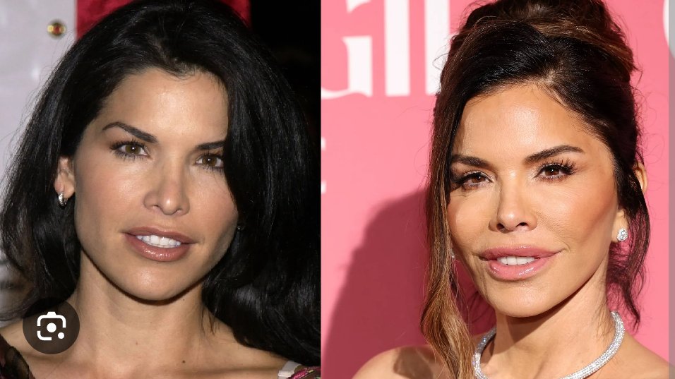 <a href="/HustleBitch_/">HustleBitch</a> That plastic surgeon needs to be locked up for life.