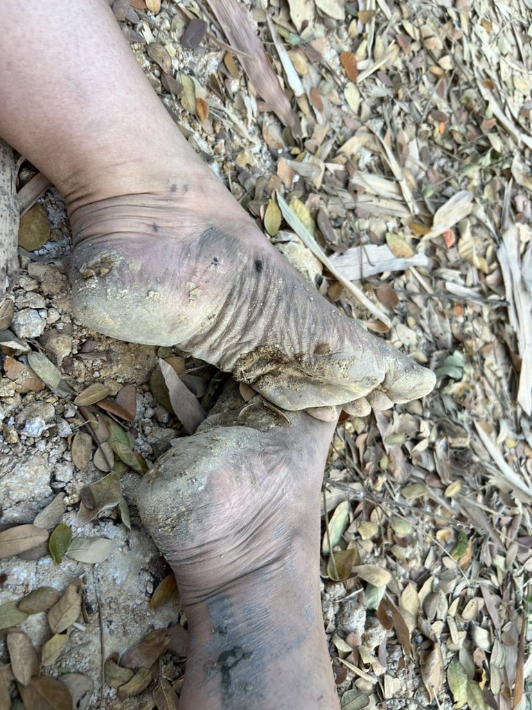 EarthStepx's tweet photo. Today: Camouflage!! #barefeet #barefooted #dirtybarefeet #barefootwalking https://t.co/swknemirk6