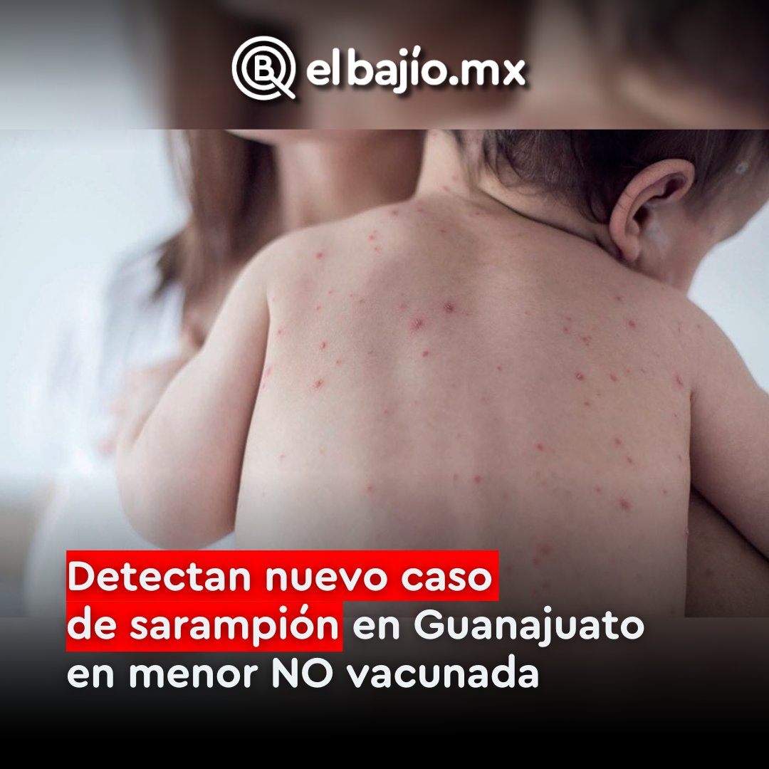 #ATENCIÓN Tercer caso de sarampión en Guanajuato. 😰

La Secretaría de Salud de Guanajuato informó que se trata de una bebé de 8 meses en León que no contaba con vacuna.

 Reportan que la menor está estable y bajo atención médica.