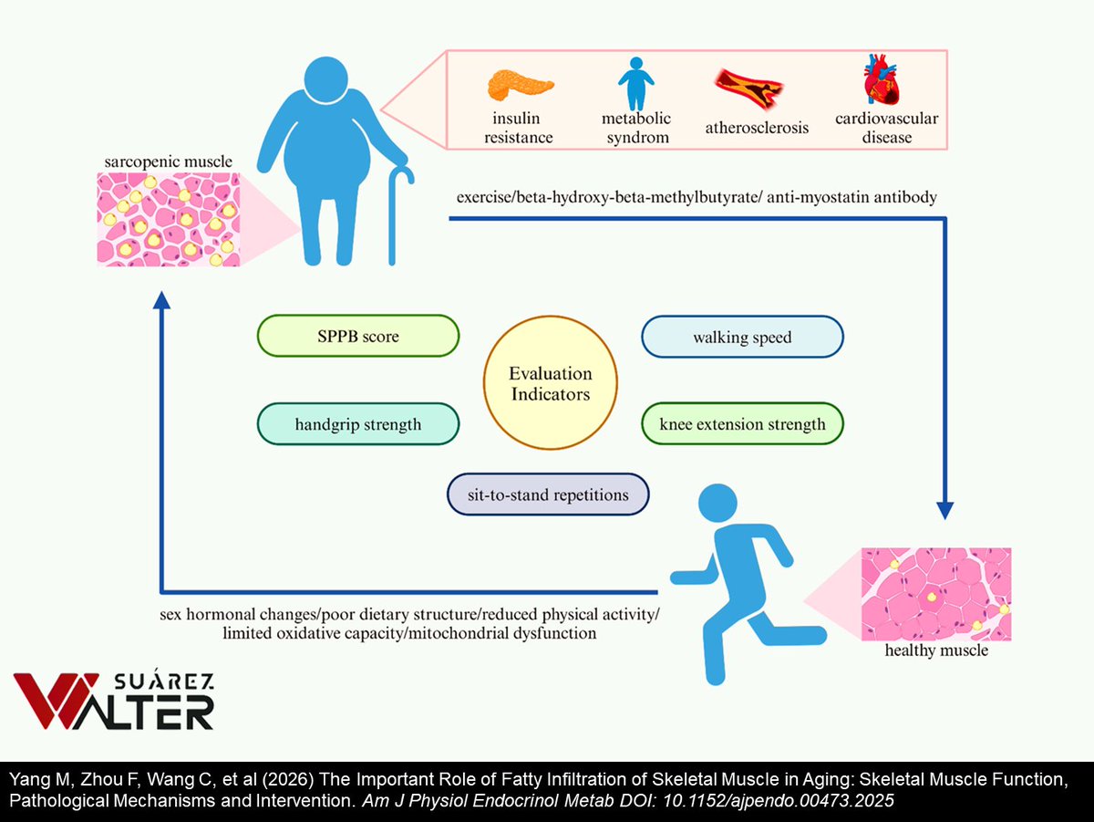 PAPEL DE LA INFILTRACIÓN DE GRASA EN EL TEJIDO MUSCULAR EN EL ENVEJECIMIENTO

¡¡¡A leer, zagales!!!

waltersport.com/investigacione…