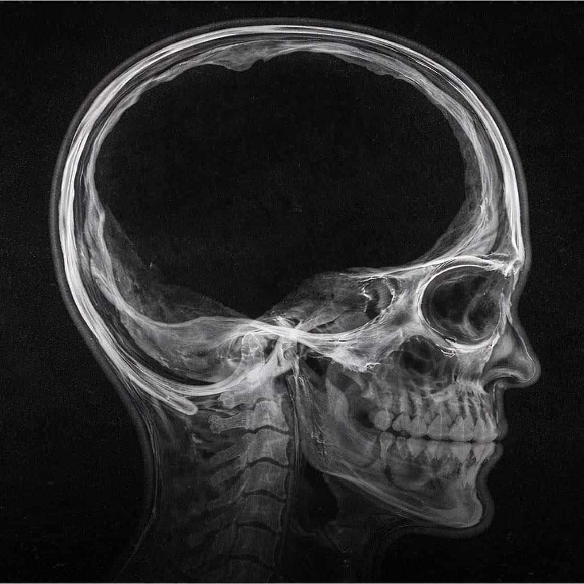 YungNoodle_ tweet media