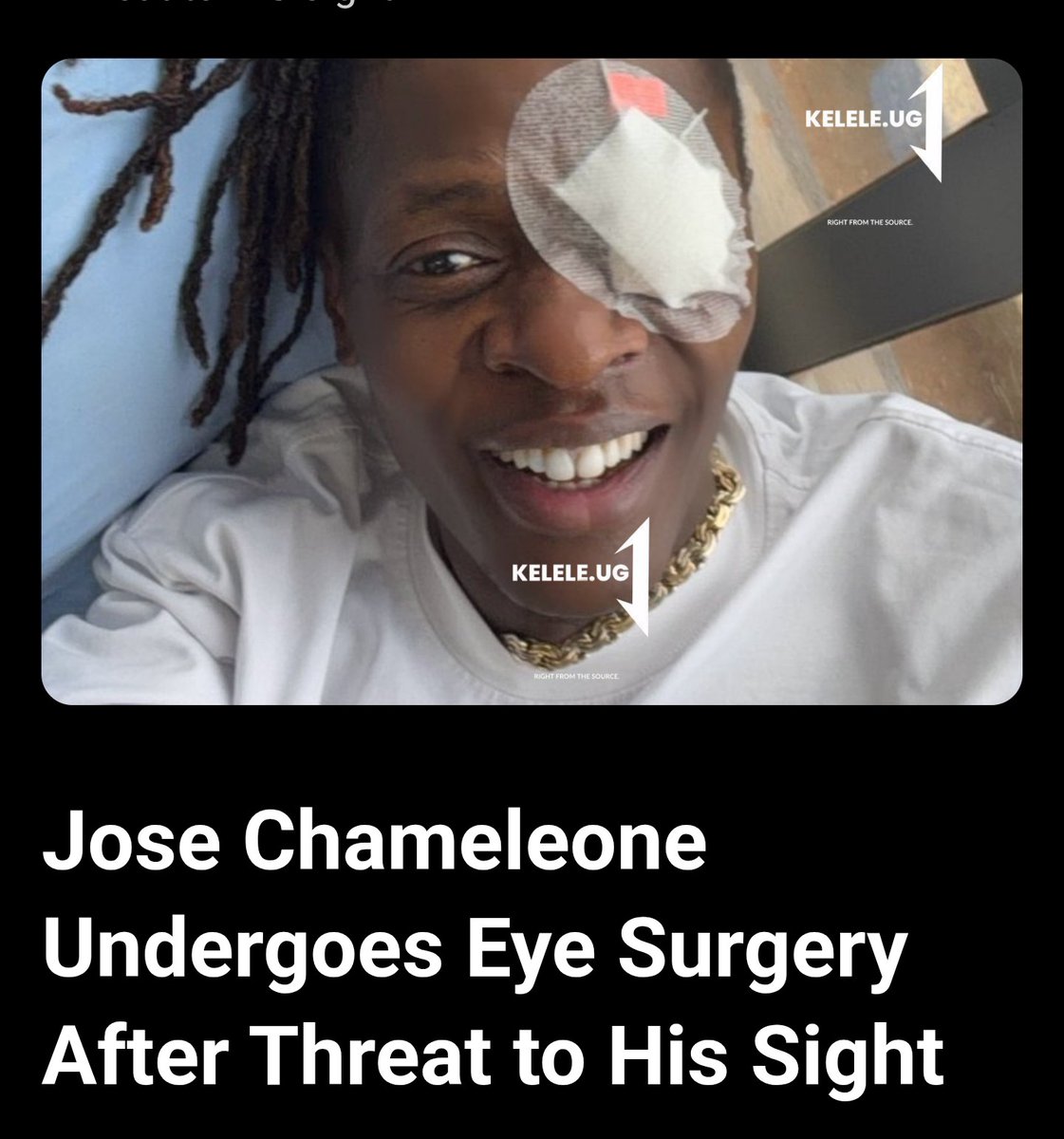 Kelele_ug's tweet photo. On Tuesday, 17 February 2026, the celebrated singer took to his social media platforms to reveal that he had been at risk of losing vision in his right eye. The artist shared a photo showing his eye covered with a plaster following the procedure. https://t.co/SVLLPyaBHa