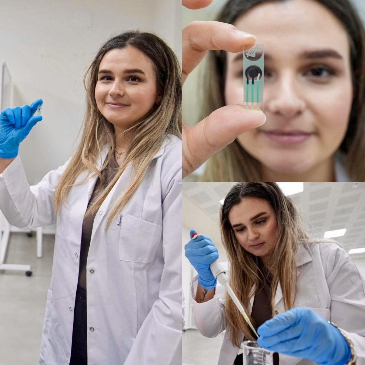 İzmir’de 27 yaşındaki mühendis Aleyna Yıldız ve ekibi, kötü huylu beyin tümörünü (glioblastoma) kan, idrar ve tükürük gibi vücut sıvılarından dakikalar içinde tespit edebilen elektrokimyasal biyosensör geliştirdi. 🇹🇷 👏