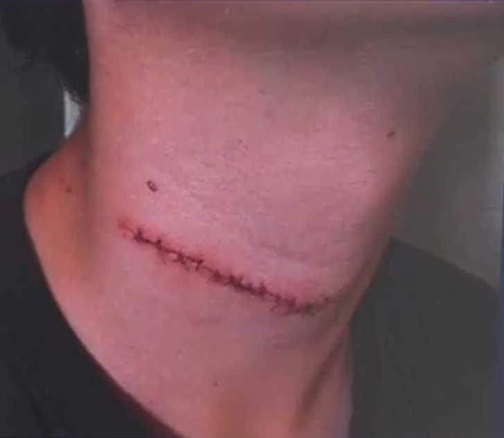 13-year-old Sullivan Clarke was ONE MILLIMETER away from becoming the next Iryna Zarutska.

Why do attacks like this keep happening?