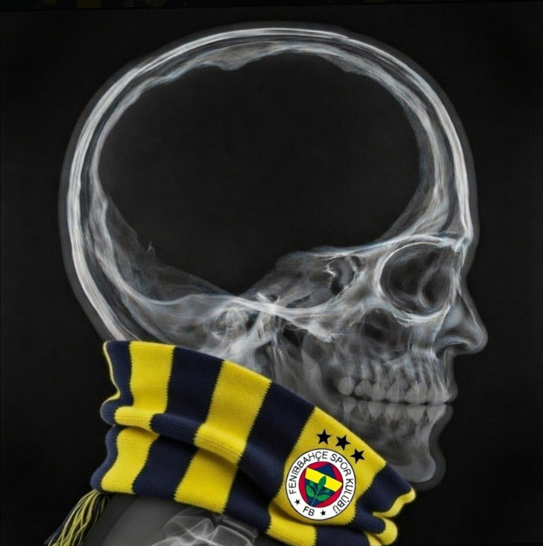 Juventus eski Juventus değil  #GSvJUVE