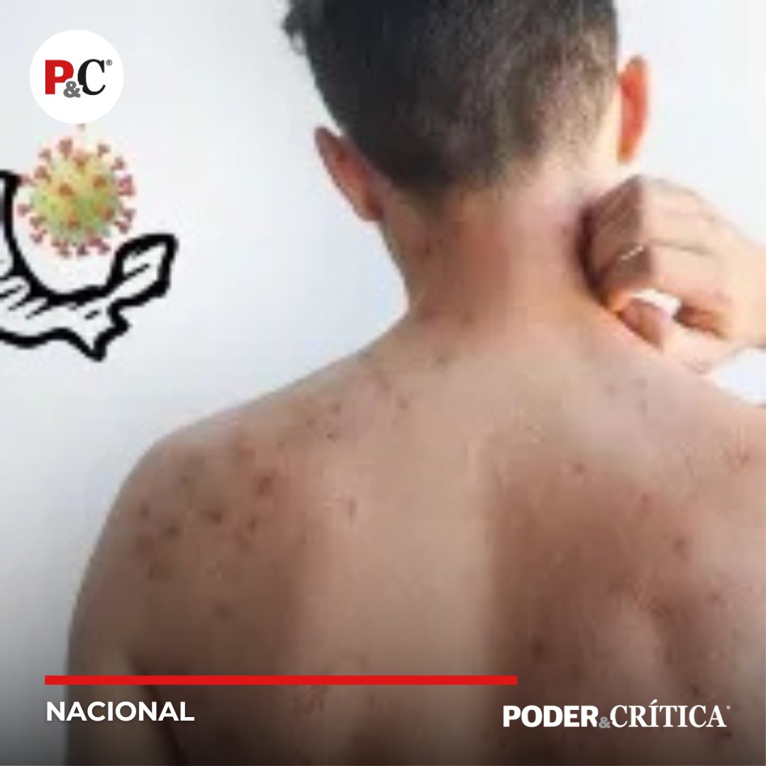 #Nacional | Sarampión en México: Aumentan a 31 las Muertes por la Enfermedad

poderycritica.com/sarampion-en-m…