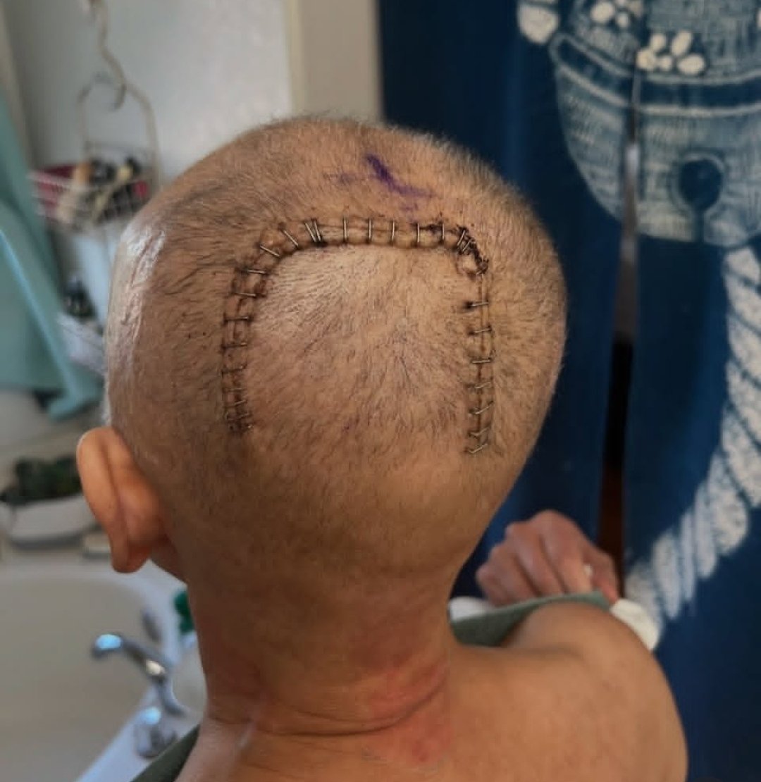 AnnaBells597404's tweet photo. Please 🙏 consider donating and or sharing. I'm struggling financially. 

#cancer #CancerTreatment #cancerdonation #OMG #fightingcancer https://t.co/7RMFbC5ri7