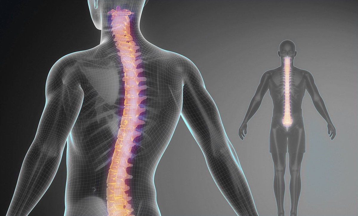 forallcurious's tweet image. 🚨: The most influential woman in South America right now is Tatiana Sampaio.

This woman is changing lives with the possible cure for quadriplegia. We may be witnessing one of the greatest discoveries in the history of medicine.