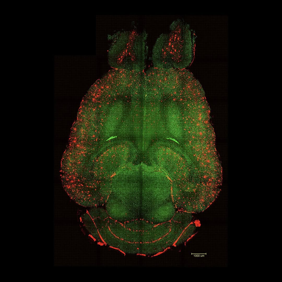 forallcurious's tweet image. 🚨:  Chinese scientists reverse Alzheimer in mice and restore memory
using 40 Hz sound waves ─ no drugs─ no surgery. 

Just frequency.