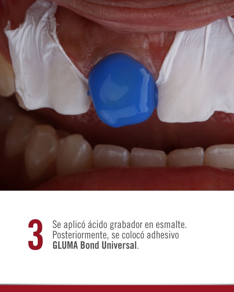 Kulzer México tweet media