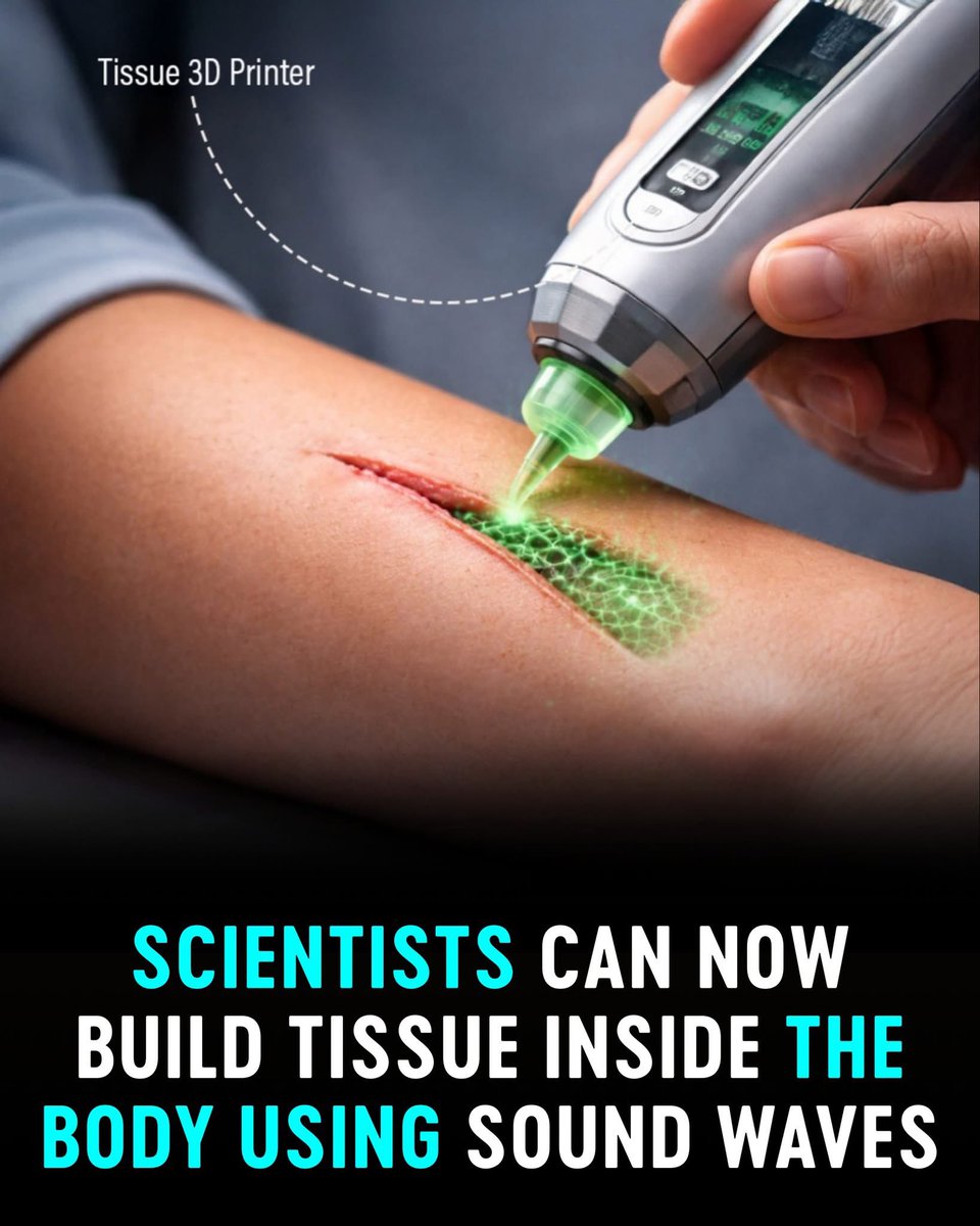 BrainyScience's tweet image. 🚨 THEY TURNED SOUND INTO LIVING STRUCTURES. What Scientists Just Did Inside the Human Body Will Leave You Speechless

Imagine doctors printing tissue inside your body without surgery. No cuts. No stitches. Just sound. It sounds unreal, but researchers at California Institute of