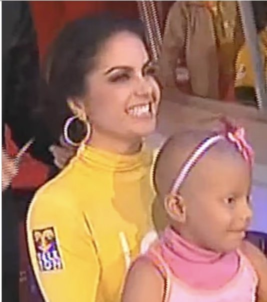 En el año 2009 durante el <a href="/TeletonMexico/">Teletón México</a> <a href="/LuceroMexico/">Lucero</a> donó su cabello para 
apoyar a una niña que luchaba contra el cáncer, acto incitado por Rebecca de Alba con su llamado “Pelontón”. 
#LuceroContigo