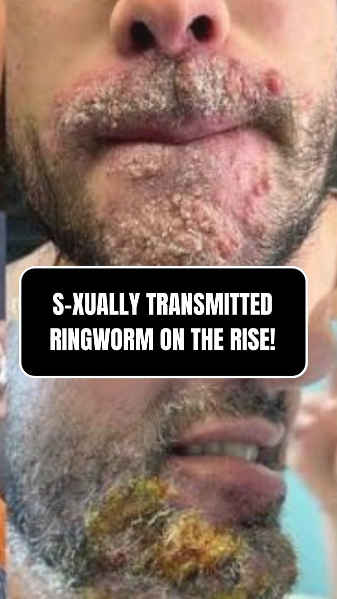 Nicole Angemi, MS, PA (ASCP) tweet media