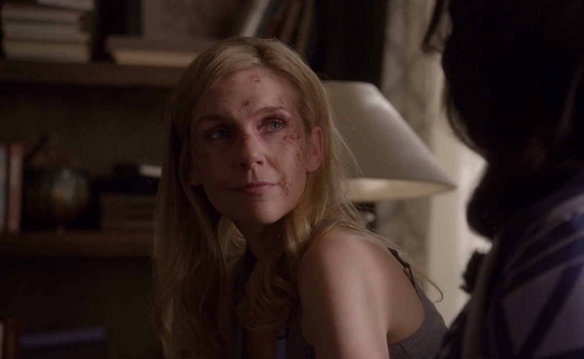 prettiest road traffic accident victim