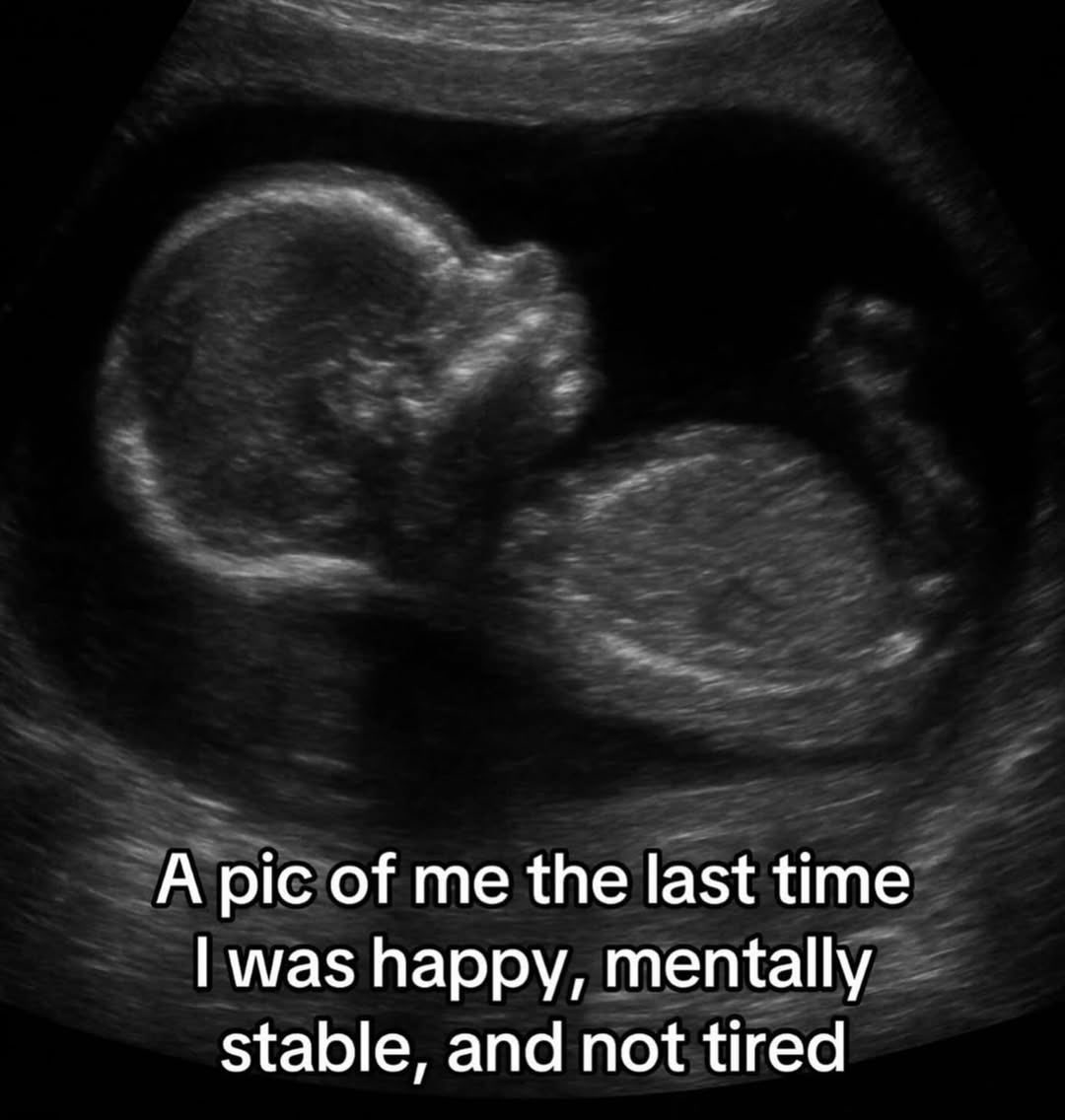 Theana (@realiazed) on Twitter photo 