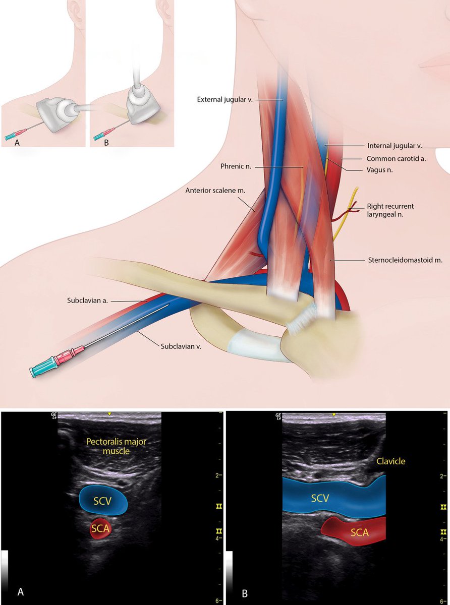 NephroPOCUS tweet media