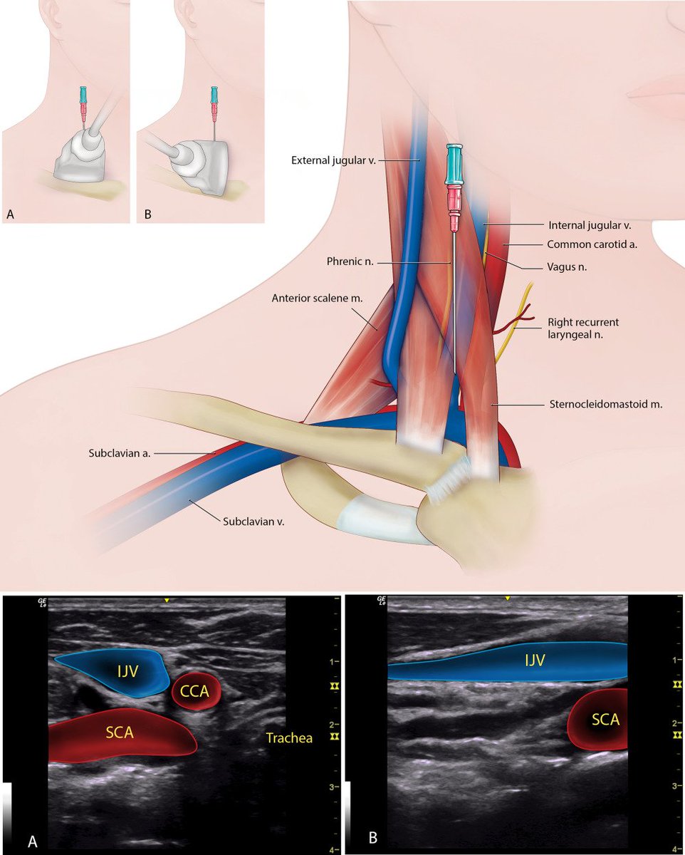 NephroPOCUS tweet media