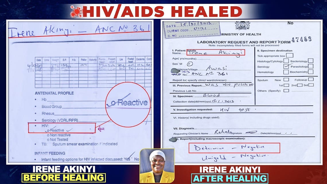 The Blood of JESUS has Power and authority that defeats science, defeats medicine, defeats human wisdom and education.

This has been confirmed by this classic HEALING of HIV AIDS. Take a look at these 3 cases confirmed by Government Doctors.

#BloodOfChristDeletesHIV