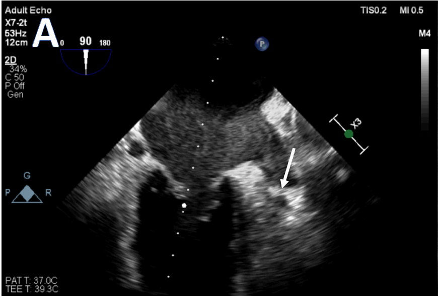 Journal of Invasive Cardiology tweet media
