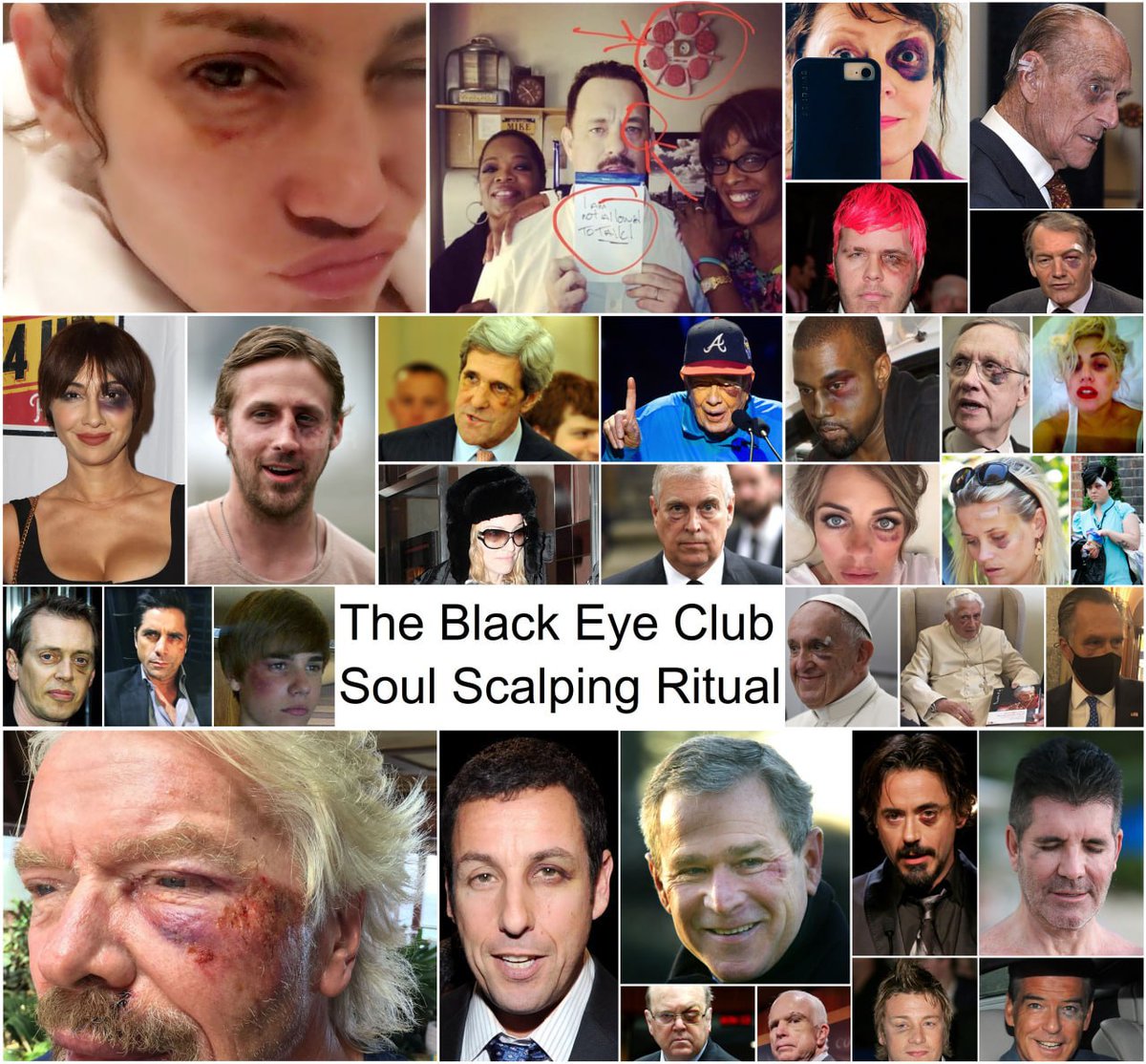 FranceRsistanc1's tweet image. ⚠️ 🦎Parasite reptilien lézard Vril🦎
Processus de bourdonnement de la trompe alias.
Arrachage de corps/scalping d'âme #Rituel

👁‍🗨Le Black Eye Club #Illuminati
#HCQ tue le #Vril 🦎🐍👽