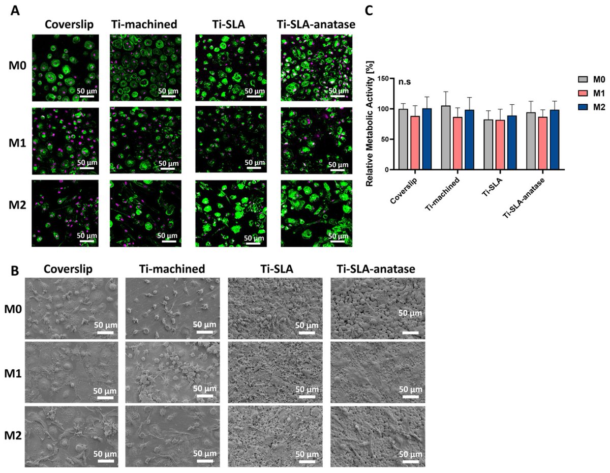 JFB_MDPI's tweet image. 🔔 Read one of our papers published "Influence of Micro-Nanostructured Anatase-Coated SLA Titanium on Macrophage Behavior" by Ms. Stefanie Krajewski et al.

🔗 𝐋𝐢𝐧𝐤: brnw.ch/21x0fb5

#TitaniumImplants #DentalImplants