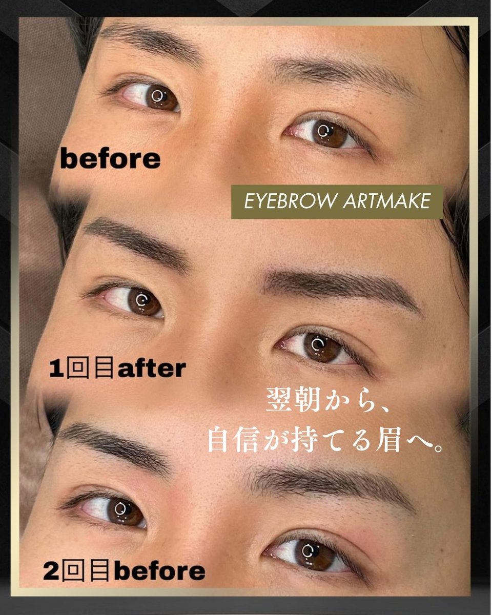 公式】メディカルブロー Medicalbrows【アートメイク