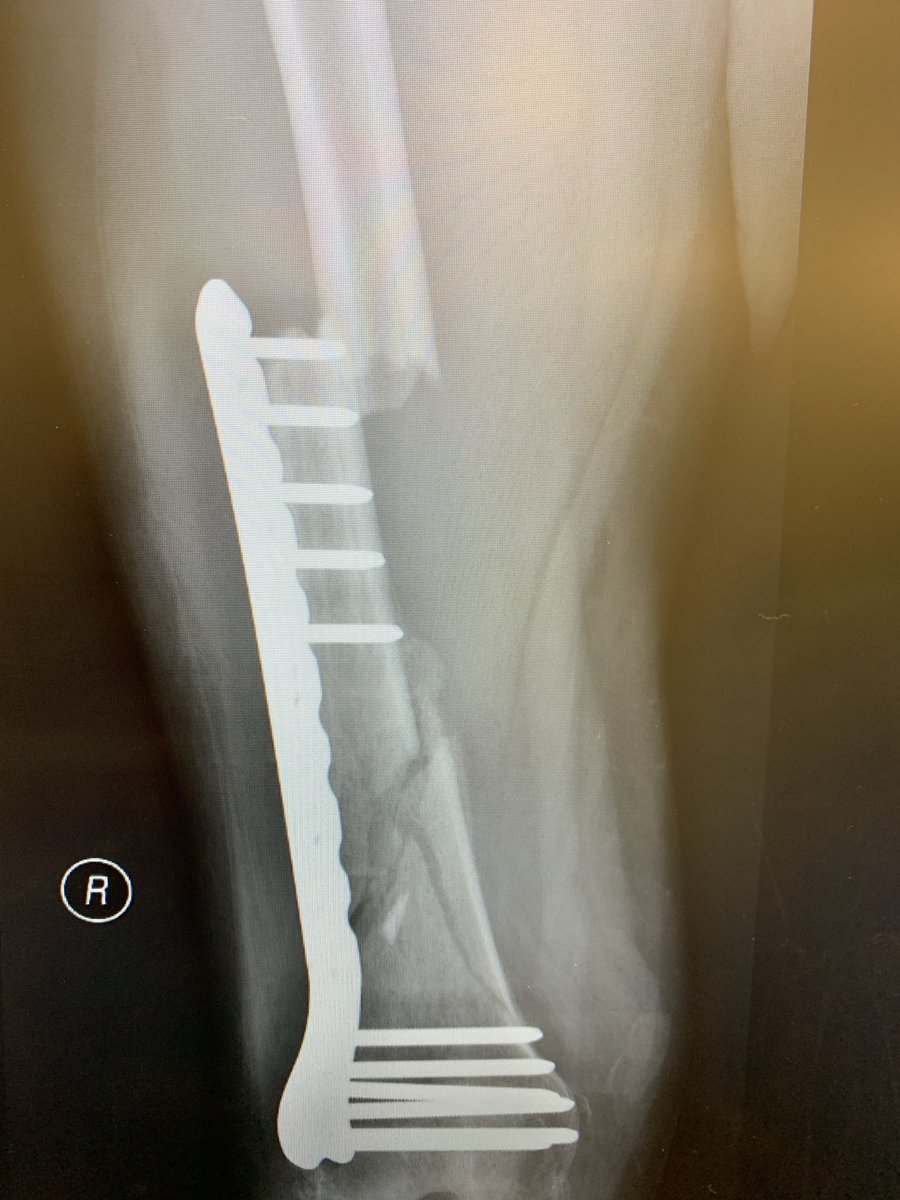 SP Orthopaedics tweet media