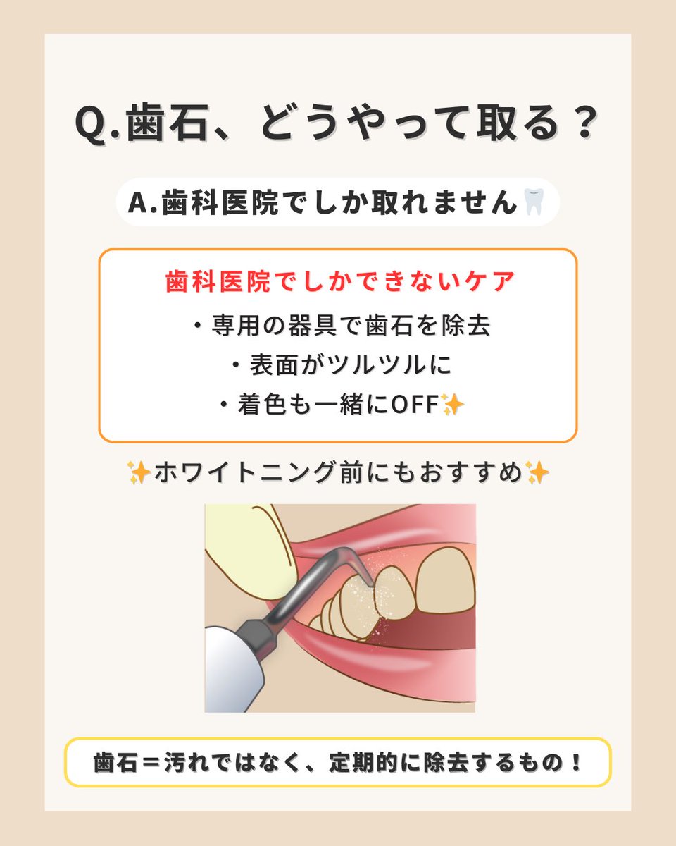 YCwhitening's tweet photo. 歯石はただの汚れではなく
“トラブルの巣“になるもの。

歯石が付くと表面がザラつく→細菌が付きやすくなる🦠→歯ぐきの炎症や出血に🩸

毎日磨いていても防ぎきれないからこそ、定期的な除去が必要です。

放置せず、きちんとクリーニングでリセットを。 https://t.co/BIZPAeV9XU