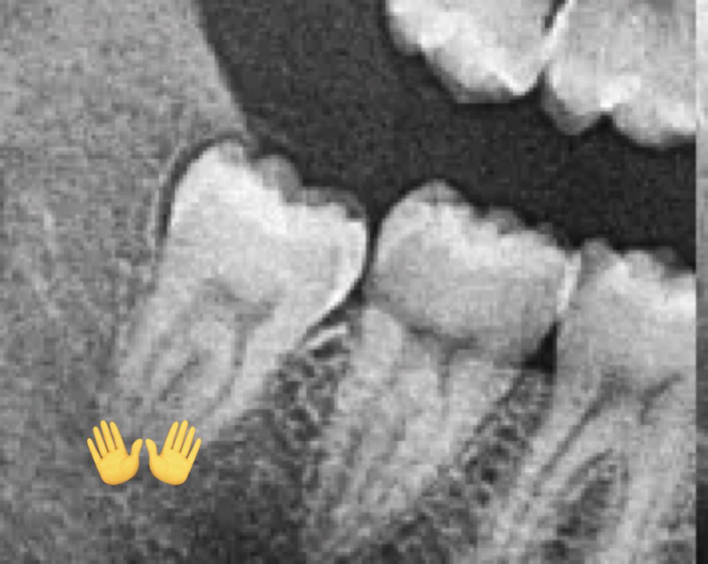 ra edisi lagi jadi koas gigii🦷 tweet media