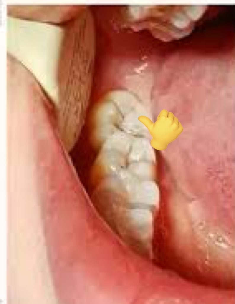 ra edisi lagi jadi koas gigii🦷 tweet media