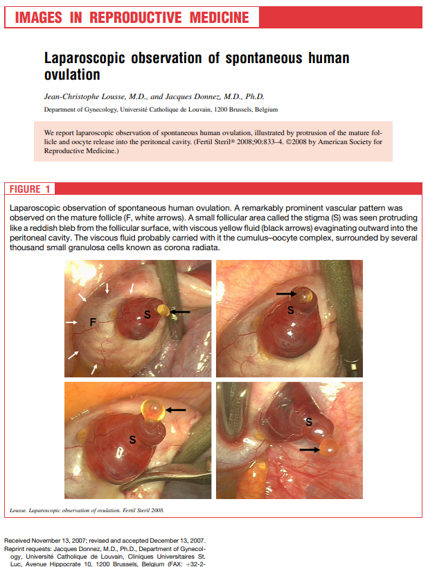 hkjoogo's tweet photo. wow.. never seen this before even though this photo was released in 2008.

Source:
Fertility and Sterility, Volume 90, Issue 3, September 2008, Pages 833-834
