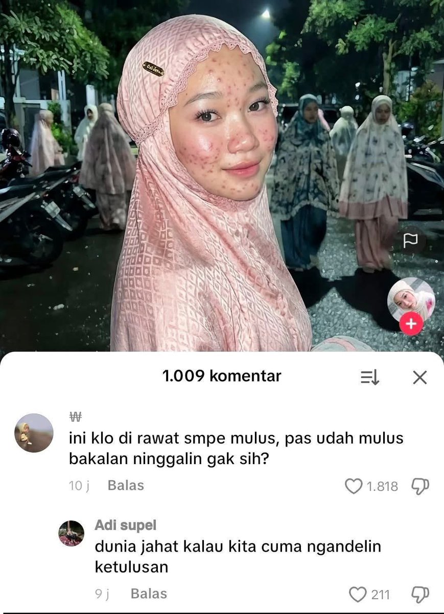 Atmint adi supel punya pengalaman pait sepertinya