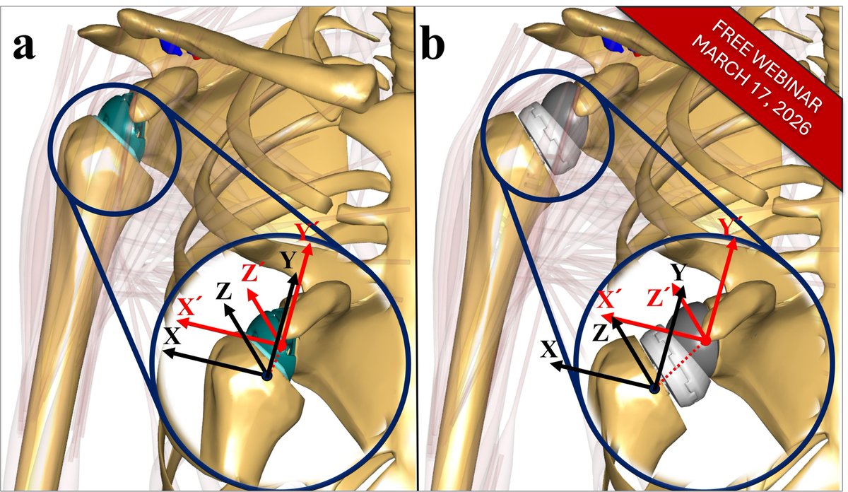 AnyBodyTechnology tweet media