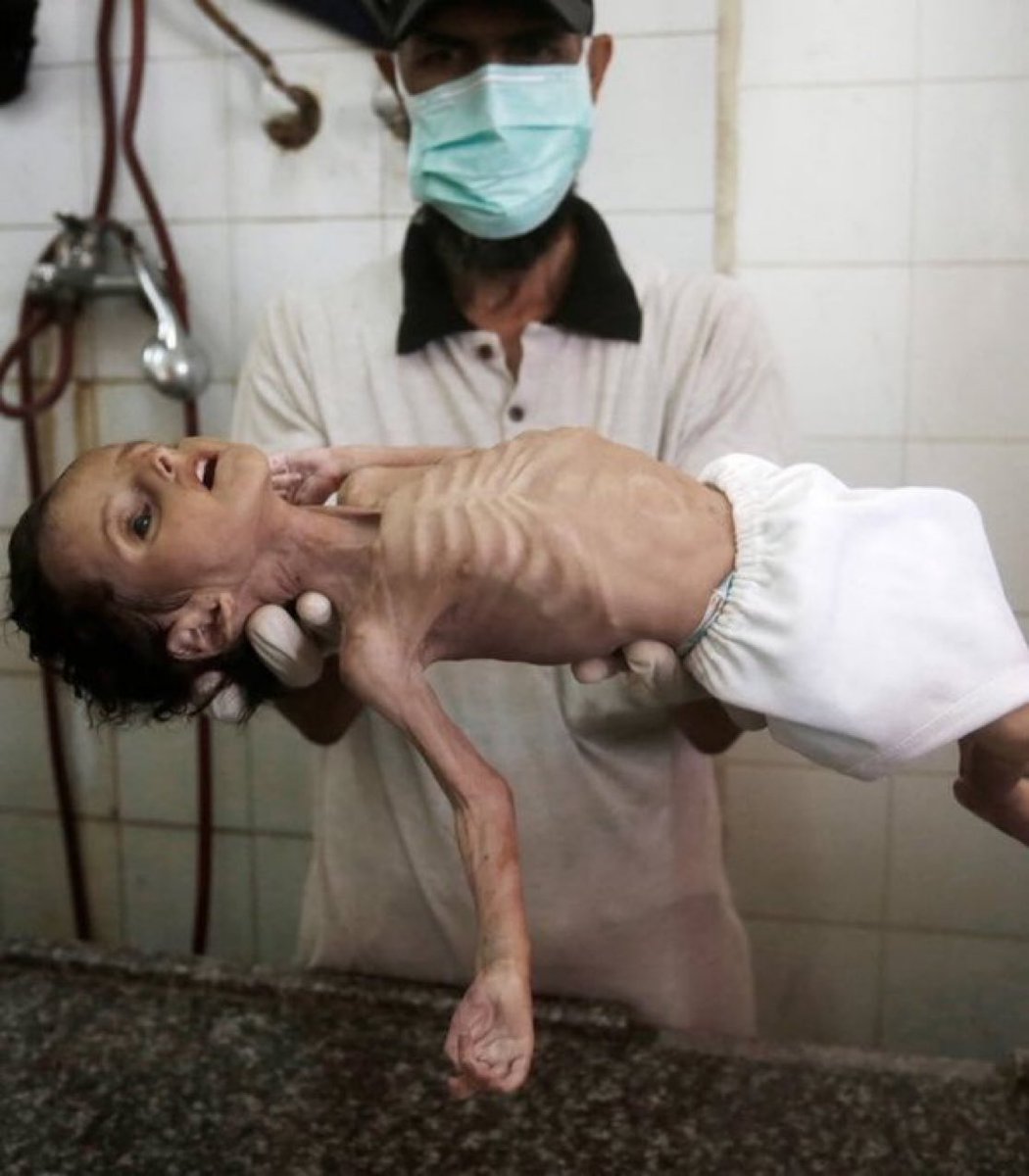 لا تتوقف عن النشر فصمتك خيانة

لا خير فينا اذا نسينا